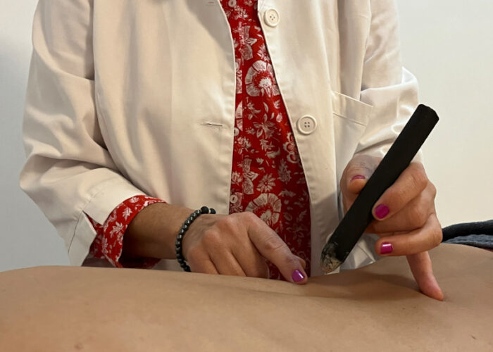 Servicio acupuntura y moxibustion 1