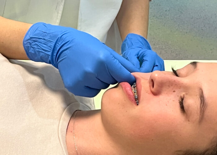 Servicio fisioterapia ATM 5