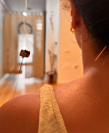 acupuntura-y-moxibustion-terapia-corporal